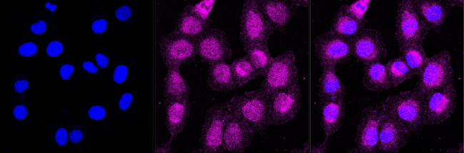 ACSL4 Antibody in Immunocytochemistry (ICC/IF)