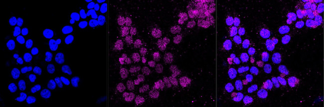 CD58 Antibody in Immunocytochemistry (ICC/IF)