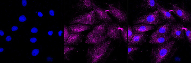 Caveolin 3 Antibody in Immunocytochemistry (ICC/IF)