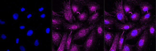 Caveolin 3 Antibody in Immunocytochemistry (ICC/IF)