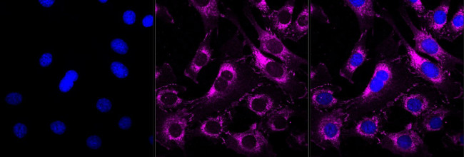 delta Catenin Antibody in Immunocytochemistry (ICC/IF)