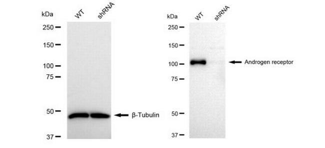 Androgen Receptor Antibody