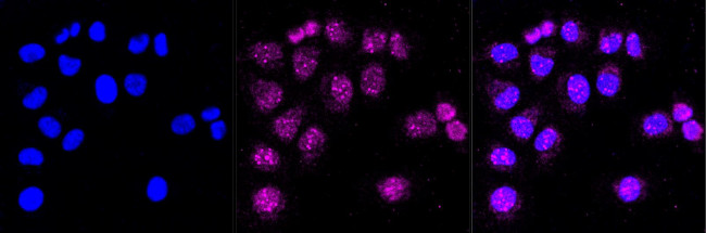 BCL-XL Antibody in Immunocytochemistry (ICC/IF)