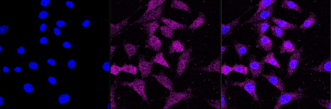 Androgen Receptor Antibody in Immunocytochemistry (ICC/IF)