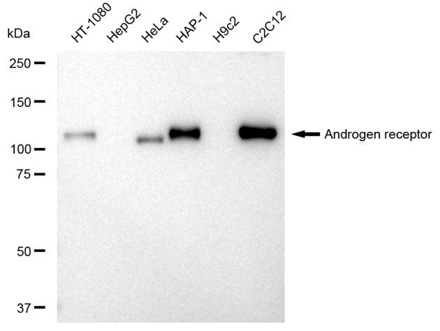 Androgen Receptor Antibody in Western Blot (WB)