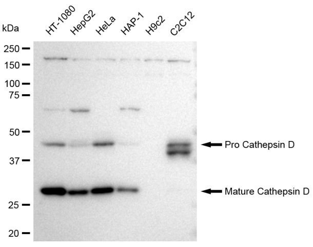 Cathepsin D Antibody in Western Blot (WB)