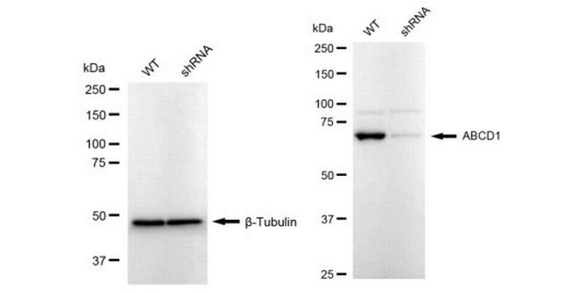 ABCD1 Antibody