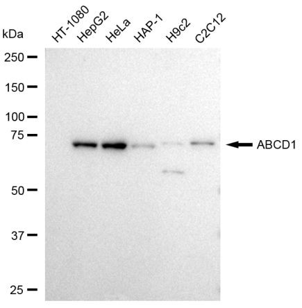 ABCD1 Antibody in Western Blot (WB)