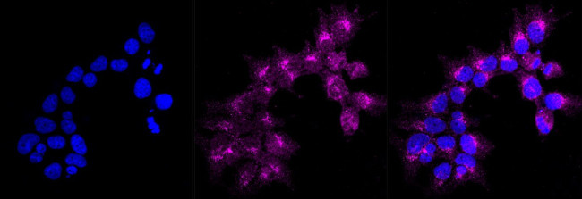 ATG9A Antibody in Immunocytochemistry (ICC/IF)