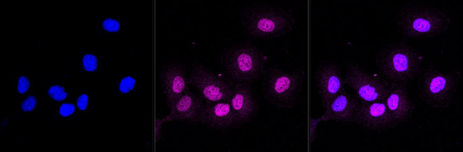 CD13 Antibody in Immunocytochemistry (ICC/IF)