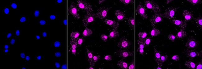 Caspase 3 p12 Antibody in Immunocytochemistry (ICC/IF)