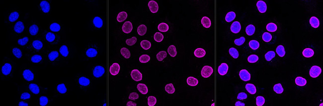 ARF6 Antibody in Immunocytochemistry (ICC/IF)