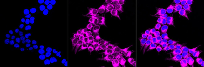 SERCA2 ATPase Antibody in Immunocytochemistry (ICC/IF)