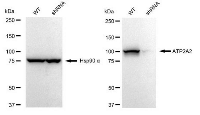 SERCA2 ATPase Antibody