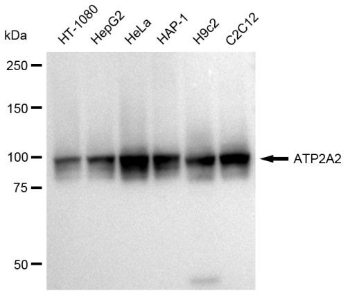 SERCA2 ATPase Antibody in Western Blot (WB)