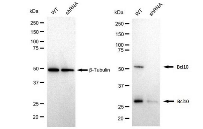 BCL-10 Antibody