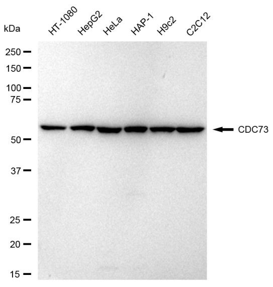 Cdc73 Antibody in Western Blot (WB)