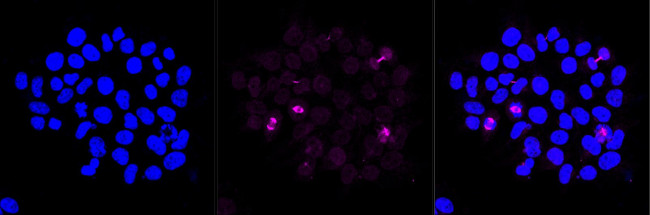 CAS Antibody in Immunocytochemistry (ICC/IF)