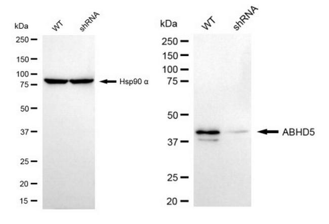 ABHD5 Antibody