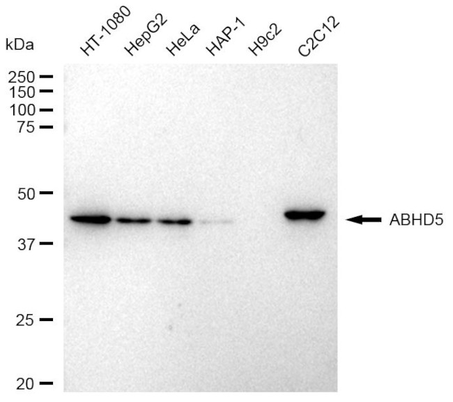 ABHD5 Antibody in Western Blot (WB)