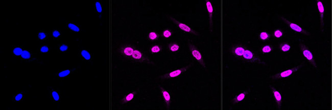 Intestinal Alkaline Phosphatase Antibody in Immunocytochemistry (ICC/IF)