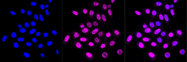 CK2 beta Antibody in Immunocytochemistry (ICC/IF)