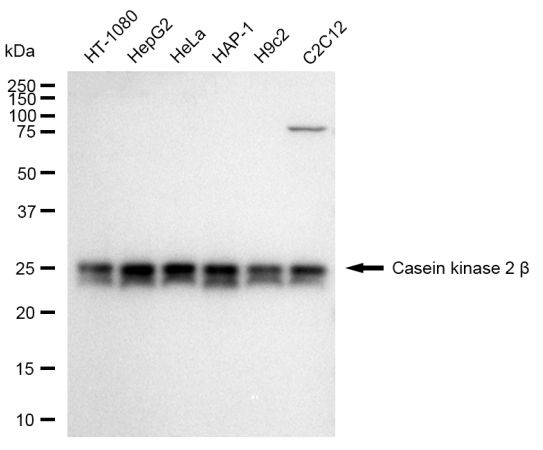 CK2 beta Antibody in Western Blot (WB)