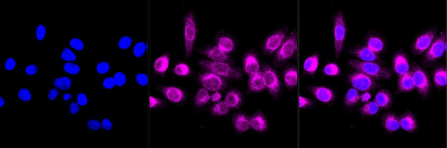 BAP31 Antibody in Immunocytochemistry (ICC/IF)