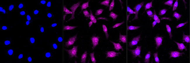 CBS Antibody in Immunocytochemistry (ICC/IF)