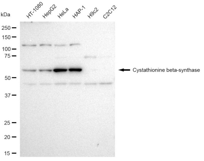 CBS Antibody in Western Blot (WB)