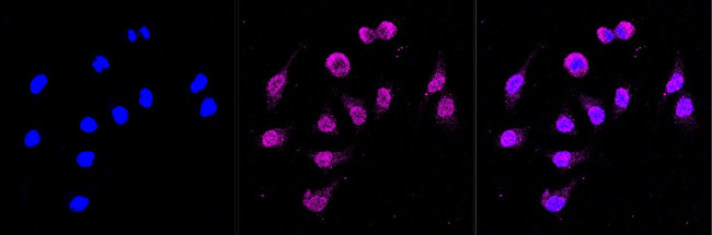 CD105 Antibody in Immunocytochemistry (ICC/IF)