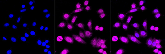 ERK1 Antibody in Immunocytochemistry (ICC/IF)