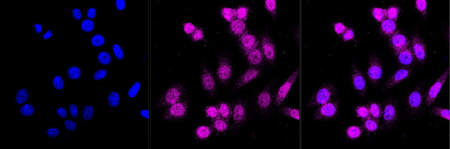 CD146 Antibody in Immunocytochemistry (ICC/IF)