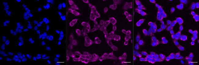 PAX6 Antibody in Immunocytochemistry (ICC/IF)