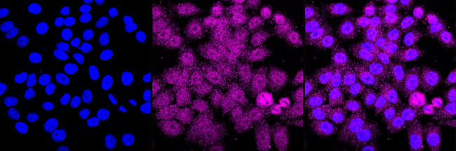 PFKM Antibody in Immunocytochemistry (ICC/IF)