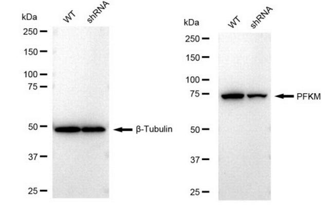 PFKM Antibody