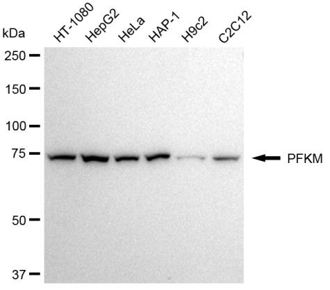 PFKM Antibody in Western Blot (WB)