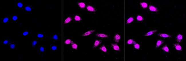 AMPK alpha-1 Antibody in Immunocytochemistry (ICC/IF)