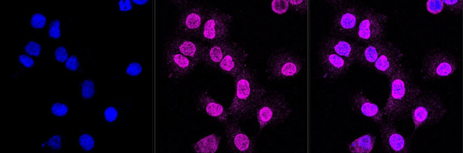 CD155 Antibody in Immunocytochemistry (ICC/IF)