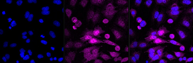 Phospho-RSK1 (Ser380) Antibody in Immunocytochemistry (ICC/IF)