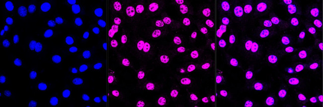 TDP-43 Antibody in Immunocytochemistry (ICC/IF)