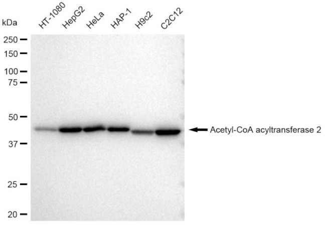 ACAA2 Antibody in Western Blot (WB)