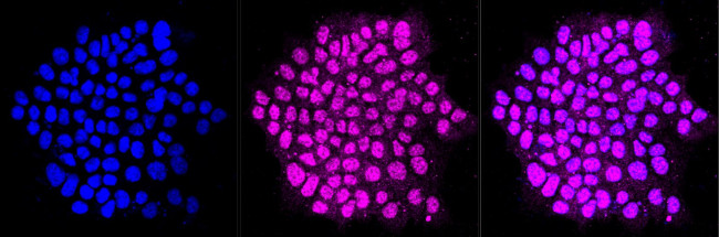 AGL Antibody in Immunocytochemistry (ICC/IF)