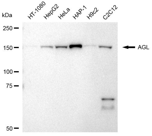 AGL Antibody in Western Blot (WB)