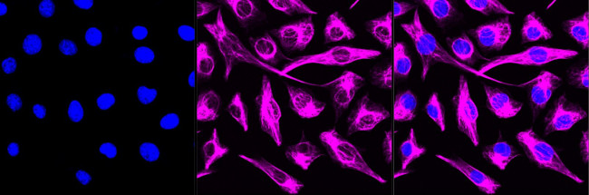 Desmin Antibody in Immunocytochemistry (ICC/IF)