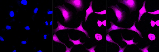 AKR1C1/AKR1C2 Antibody in Immunocytochemistry (ICC/IF)