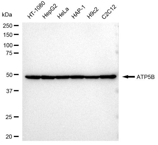 ATP Synthase beta Antibody in Western Blot (WB)