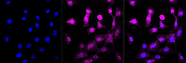 NG2 Antibody in Immunocytochemistry (ICC/IF)