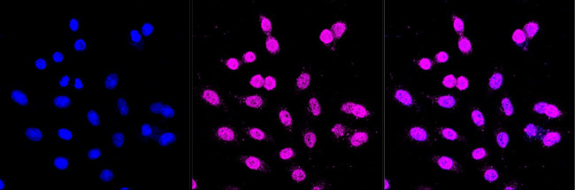 gamma Adaptin Antibody in Immunocytochemistry (ICC/IF)