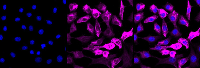 Phospho-4EBP1/2/3 (Thr46, Thr32) Antibody in Immunocytochemistry (ICC/IF)